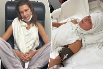 Bella Hadid fala sobre 'ansiedade médica' em meio à batalha contra a doença de Lyme
 - Printis