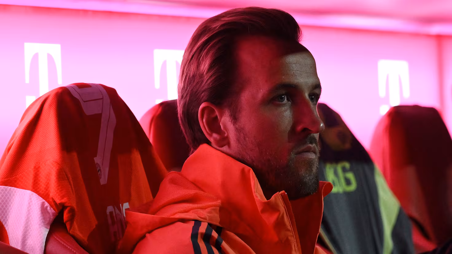 'O Guardião': Kane por Lewandowski
 - Printis