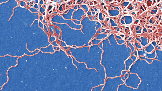 O manganês é a faca de dois gumes da doença de Lyme
 - Printis